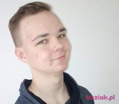 Remik, Mężczyzna, 24, Bydgoszcz, Polska: 1