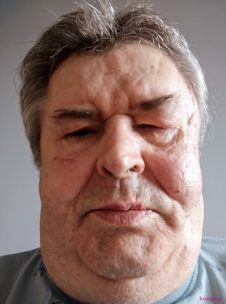 WAST, Mężczyzna, 70, Gdynia, Polska: 1