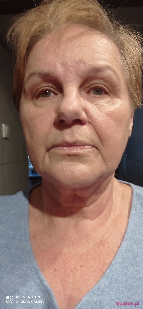anna, Female, 72, Łódź, Polska, Photo: 2